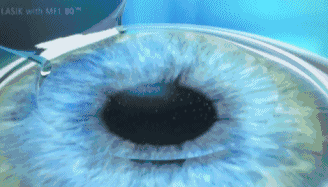 1576716326576413.gif 2.gif