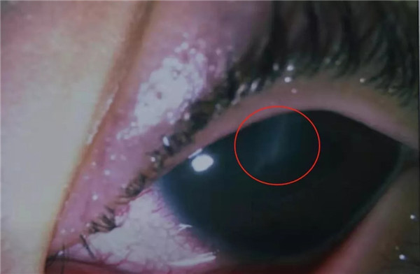 1578881537524064.jpg 2.webp.jpg