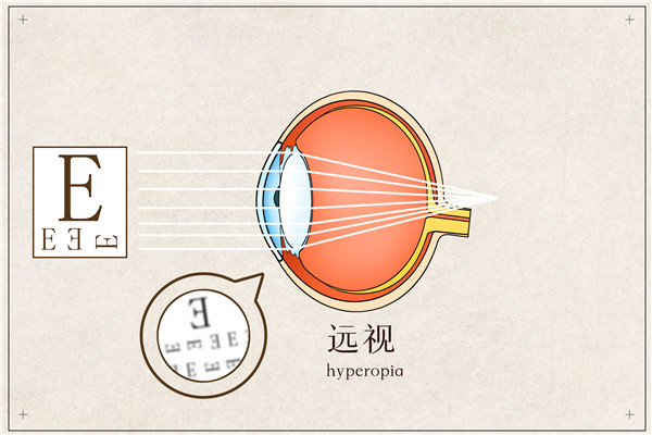 1622248419225873.jpg 摄图网_401789649_远视医疗插画(企业商用)_副本.jpg