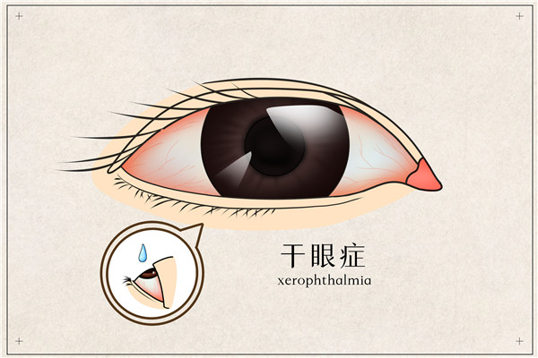 1644453810947625.jpg 摄图网_401789566_干眼症医疗插画(企业商用)_副本.jpg