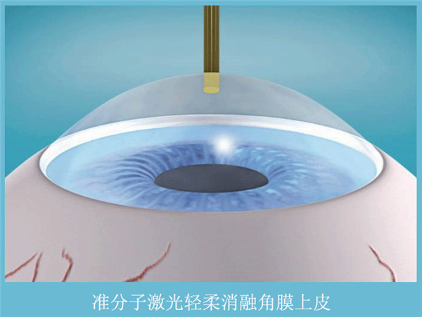 1650502573485755.jpg smart全激光动图.jpg