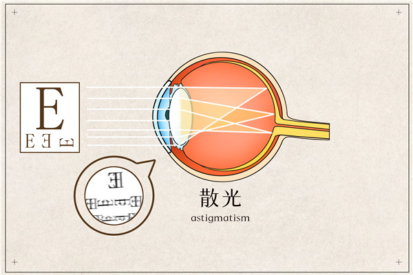 1652143058854513.jpg 摄图网_401789652_散光医疗插画(企业商用)_副本.jpg