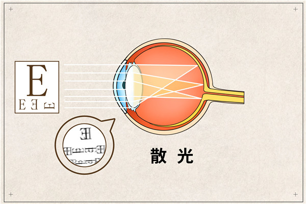 1692062673749554.jpg 摄图网_401789652_散光医疗插画(企业商用)_副本.jpg